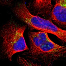 SFXN3 Antibody, Novus Biologicals 25 &mu;L | Buy Online | Novus Biologicals | Fisher Scientific